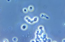 S. cerevisiae e lo zucchero - Simona Lauri